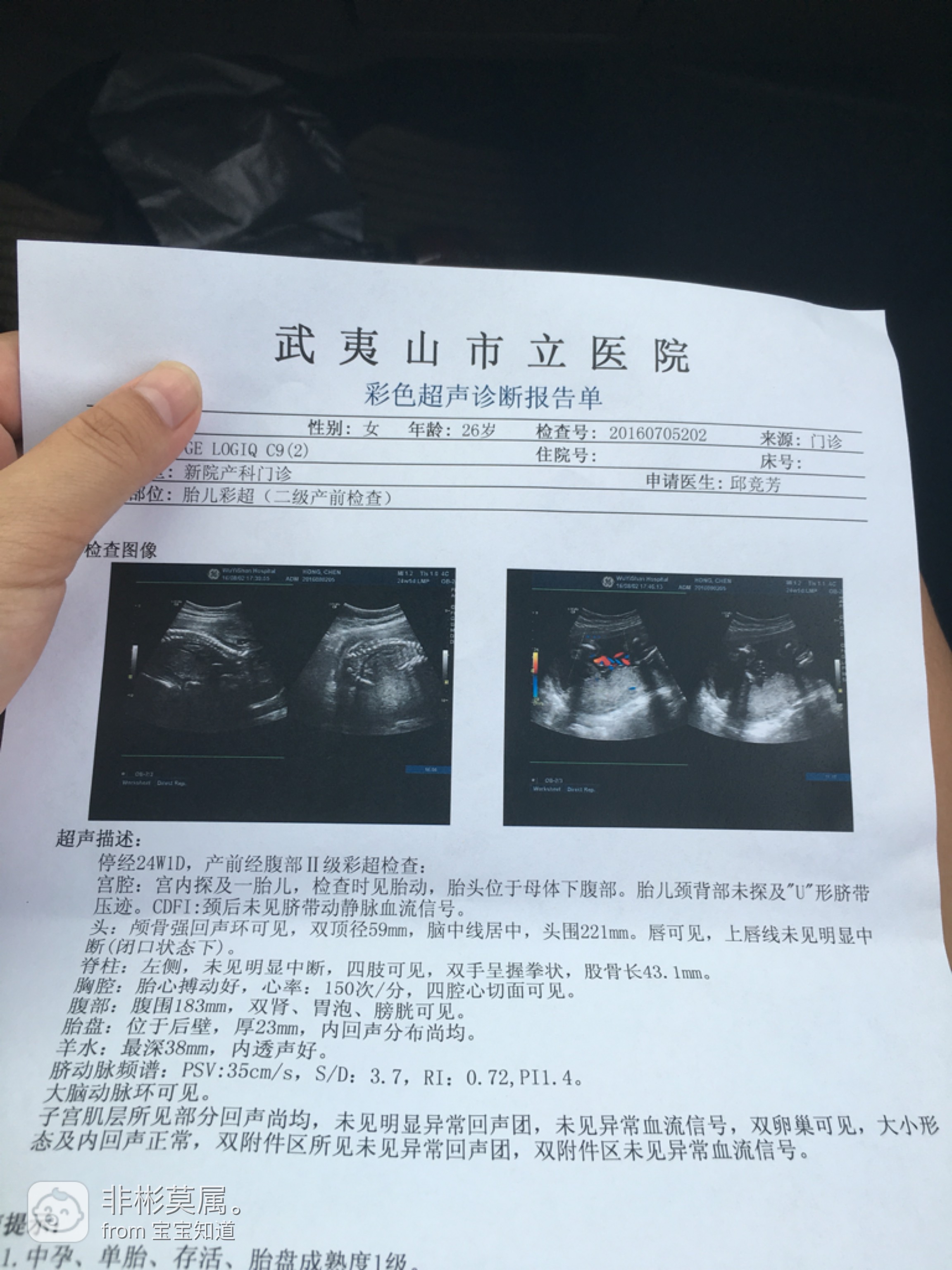 科技之光，最新彩超技术重塑健康体验之旅