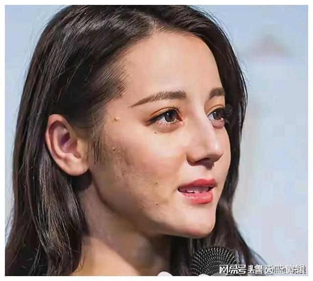 揭秘明星黑头真相，你了解多少？